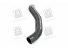Патрубок радиатора DAEWOO MAGNUS(V200) PARTS-MALL PXNLC019 (фото 4)